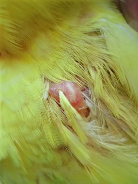 feathercyst001.jpg